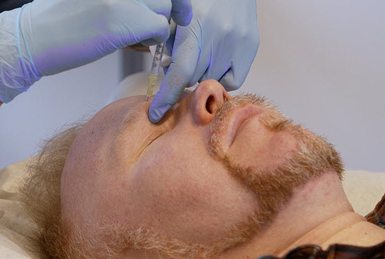  Man som får en injektion vid ögonbrynet